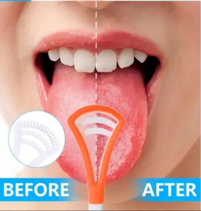 Professional Tongue Scrapers for a Healthier and Fresher Mouth